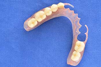Dentures in Glendale