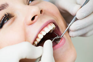 Glendale Dental Fillings