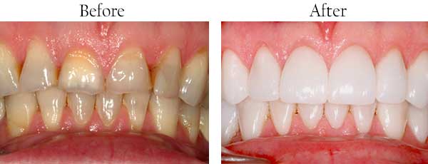 dental images 11385