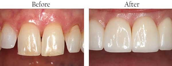 Dental Images near Bushwick