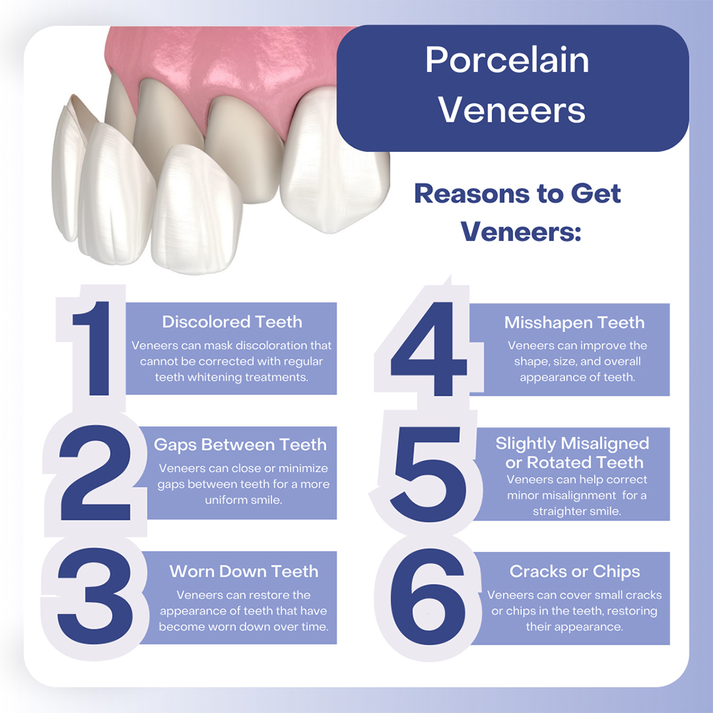 Porcelain Veneers