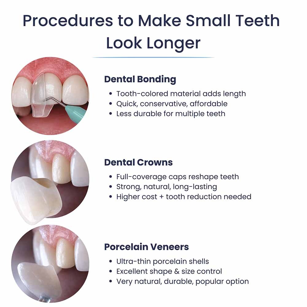 Small Teeth Microdontia Treatment Options Glendale, NY