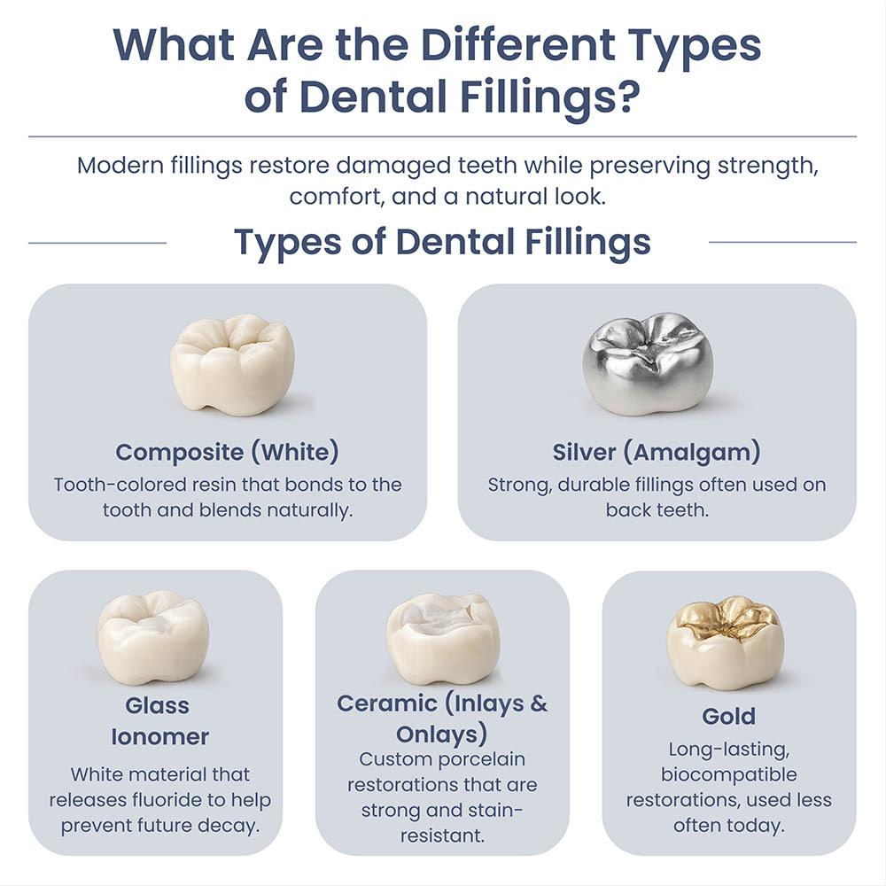 Infographic showing the different types of dental fillings including composite, silver amalgam, glass ionomer, ceramic inlays and onlays, and gold fillings used to restore damaged teeth.