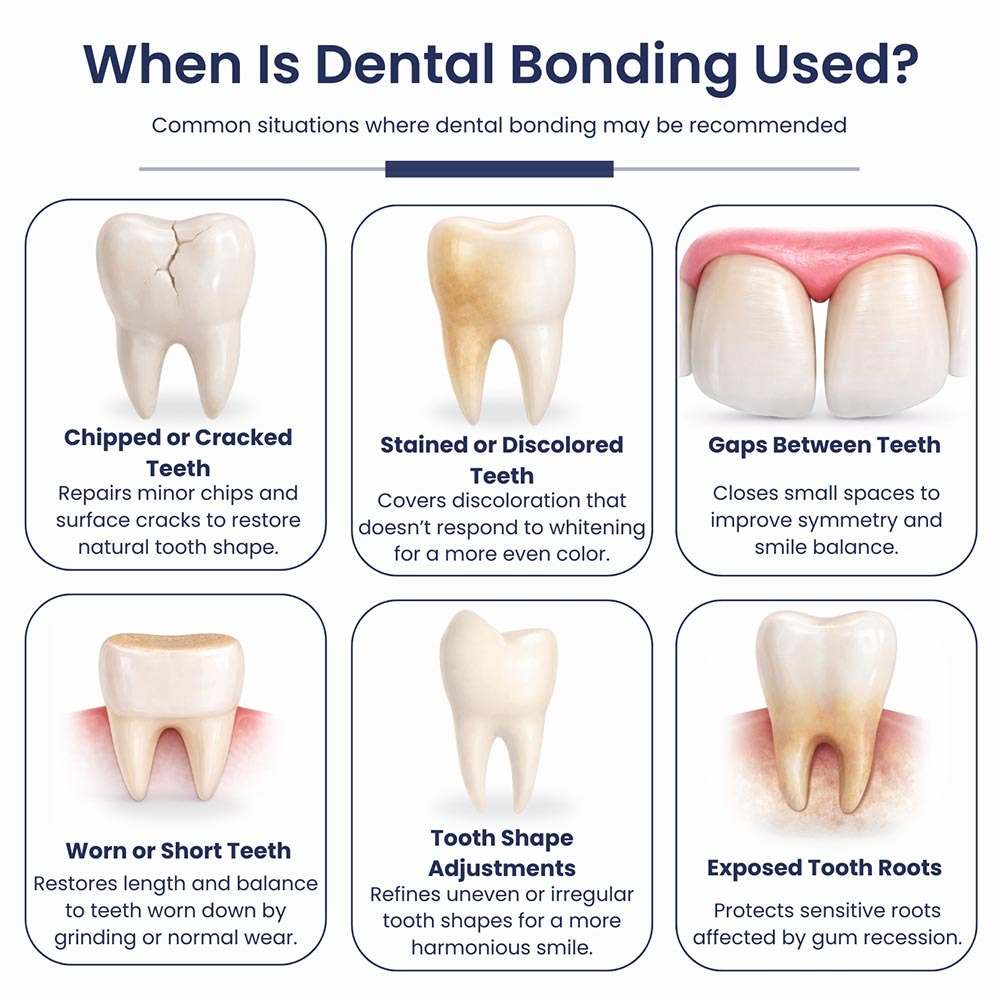Infographic illustrating common dental conditions treated with cosmetic dental bonding at Atlas Park Dental, including chipped teeth, discoloration, gaps, worn edges, shape irregularities, and exposed tooth roots.
