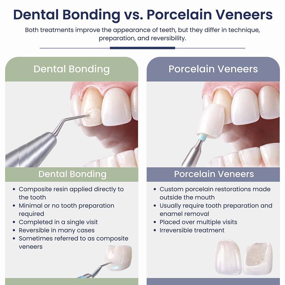 Dental bonding vs porcelain veneers infographic comparing cosmetic dentistry treatments, showing differences in technique, tooth preparation, and reversibility