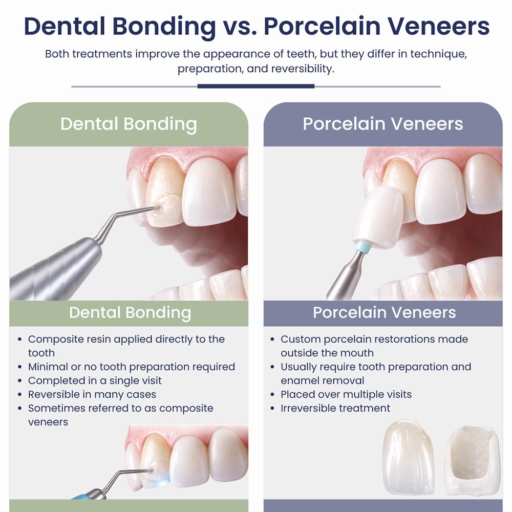 Dental bonding vs porcelain veneers infographic comparing cosmetic dentistry treatments, showing differences in technique, tooth preparation, and reversibility
